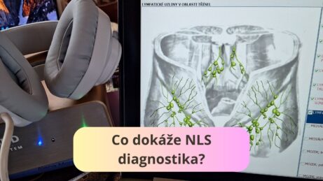 Co dokáže NLS diagnostika?