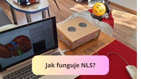 Jak funguje NLS