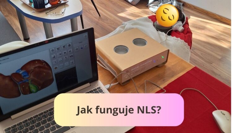 Jak funguje NLS